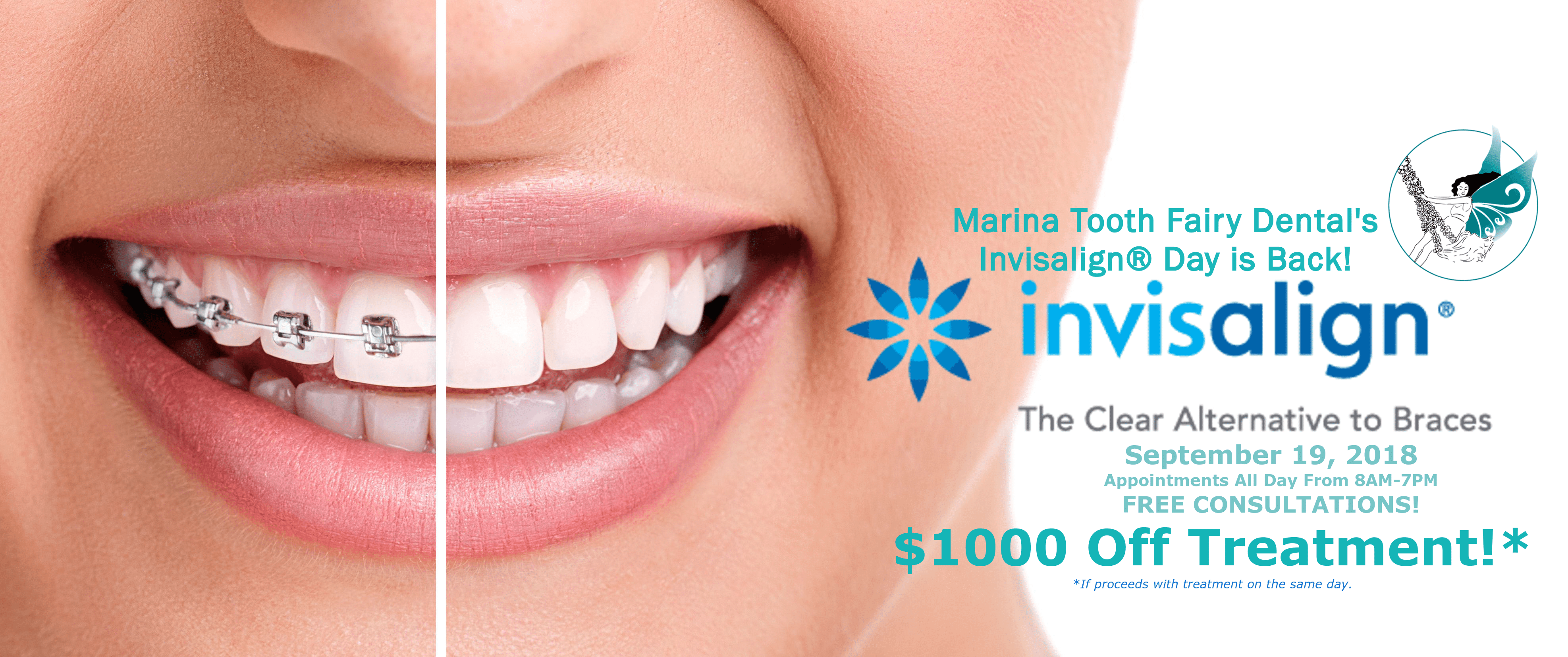 Invisalign® Day is Coming Back! - Marina Tooth Fairy Dental